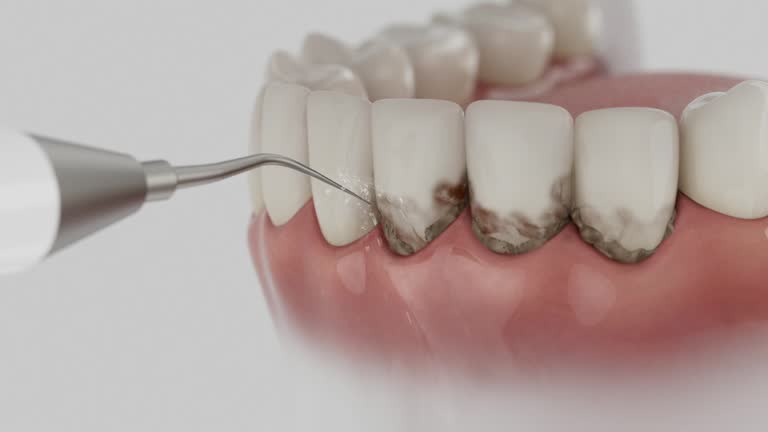 Reliable Dental contractor in Hagerstown, MD by Dentist Open Now
